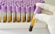 Hemogram Hgb Yüksek ve Düşük Olması Hemogram Hgb Yüksek ve Düşük Olması