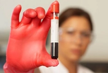 Mch Hemogram Düşüklüğü ve Yüksekliği Mch Hemogram Düşüklüğü ve Yüksekliği