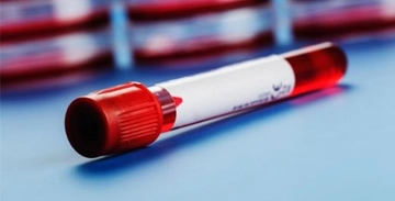 Hemogram Mch Nedir? Hemogram Mch Nedir?