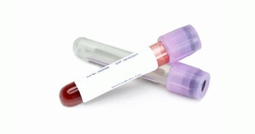 Hemogram Mono Nedir? Hemogram Mono Nedir?