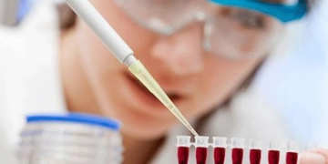 Hemogram Rdw Nedir? Hemogram Rdw Nedir?