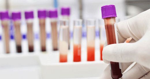 Hemogram Eos Normal Değerleri