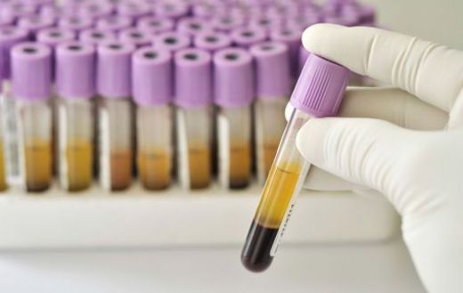 Hemogram Hgb Yüksek ve Düşük Olması