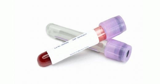 Hemogram Mono Nedir?