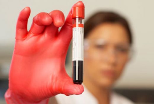 Mch Hemogram Düşüklüğü ve Yüksekliği