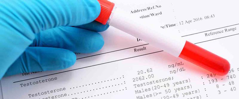 Bebeklerde Hemogram Nedir ve Kaç Olmalıdır?